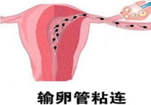 做试管婴儿生男孩的几率大吗,试管婴儿生男孩的概率高吗