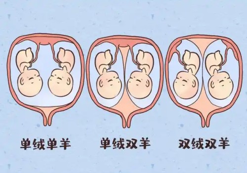 怀唐氏儿的孕妇感觉有哪些症状？这样预防唐氏效果更好